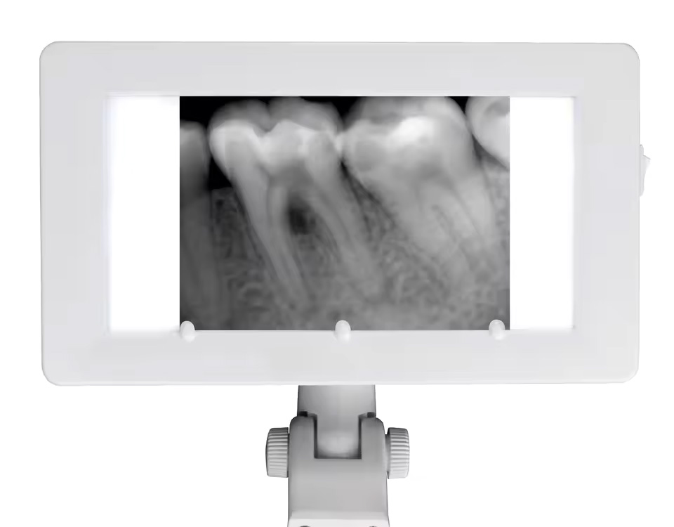 Dental X-ray Film (8)